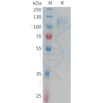 sp-PME101351 CD62E Fig.1 SDS PAGE 1