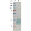 sp-PME101355 APLN Fig.1 SDS PAGE 1