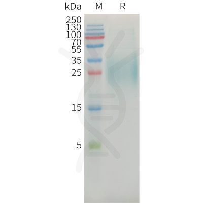 sp-PME101357 MICAa3 Fig.1 SDS PAGE 1