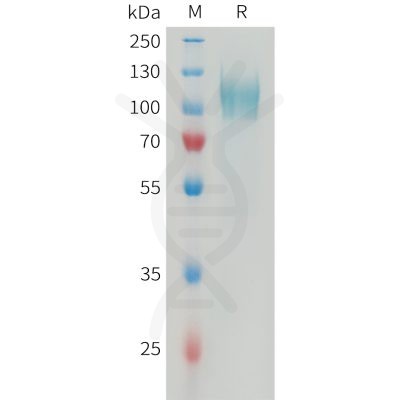 sp-PME101358 PDGFRA Fig.1 SDS PAGE 1