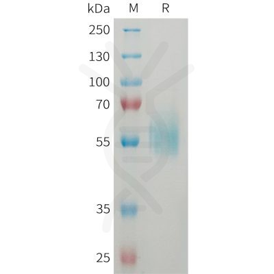 sp-PME101359 ST2 Fig.1 SDS PAGE 1