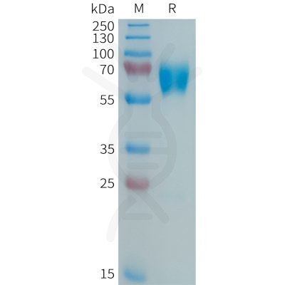 sp-PME101362 MMP8 Fig.1 SDS PAGE 1