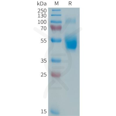 sp-PME101363 IL3 Fig.1 SDS PAGE 1