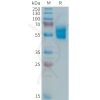 sp-PME101364 APO 1 Fig.1 SDS PAGE 1