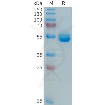 sp-PME101365 PRL Fig.1 SDS PAGE 1