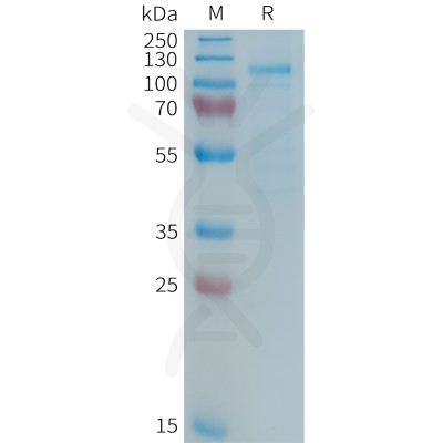 sp-PME101366 LRP5 Fig.1 SDS PAGE 1