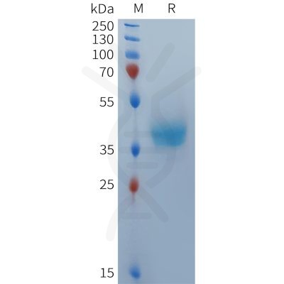 sp-PME101370 BCMA Fig.1 SDS PAGE 1