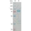 sp-PME101372 GDF8 Fig.1 SDS PAGE 1