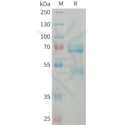 sp-PME101373 CCN2 Fig.1 SDS PAGE 1