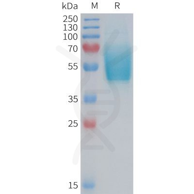 sp-PME101376 CGRPR Fig.1 SDS PAGE 1