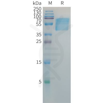 sp-PME101381 HBSAG Fig.1 SDS PAGE 1