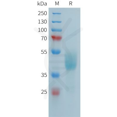 sp-PME101390 FCRL5 Fig.1 SDS PAGE 1