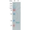 sp-PME101392 FCN1 Fig.1 SDS PAGE 1