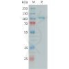 sp-PME101394 C1S Fig.1 SDS PAGE 1