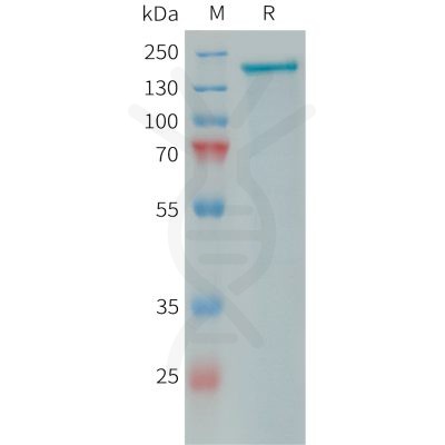 sp-PME101397 PLA2R1 Fig.1 SDS PAGE 1 1