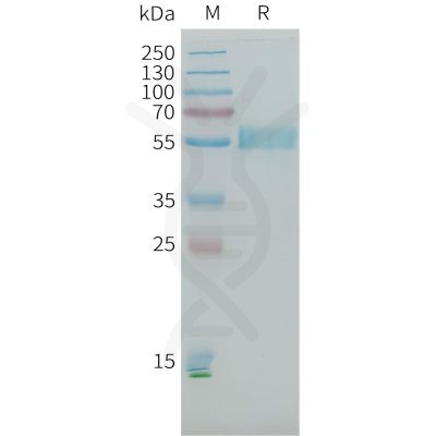 sp-PME101398 PLA2R1 Fig.1 SDS PAGE 1