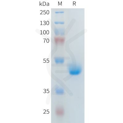 sp-PME101400 PLA2R1 Fig.1 SDS PAGE 1