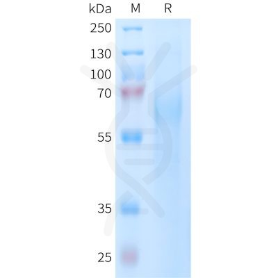 sp-PME101402 TIM4 Fig.1 SDS PAGE 1