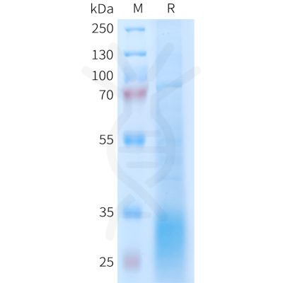 sp-PME101403 GLP2R Fig.1 SDS PAGE 1