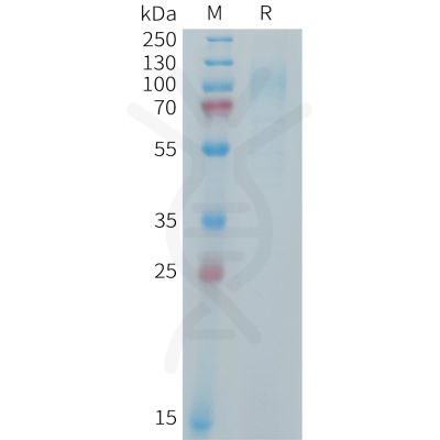 sp-PME101406 IL31RA Fig.1 SDS PAGE 1