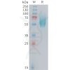 sp-PME101408 FGFR2IIIb Fig.1 SDS PAGE 1