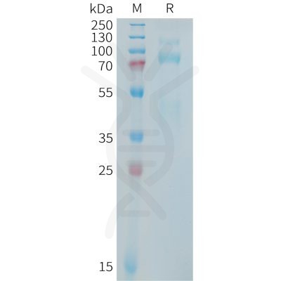 sp-PME101409 MET Fig.1 SDS PAGE 1