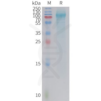 sp-PME101413 ADGRD1 Fig.1 SDS PAGE 1