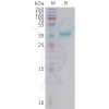 sp-PME101414 GAL Fig.1 SDS PAGE 1