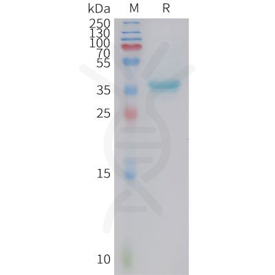 sp-PME101414 GAL Fig.1 SDS PAGE 1