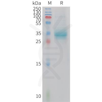 sp-PME101415 APOA2 Fig.1 SDS PAGE 1