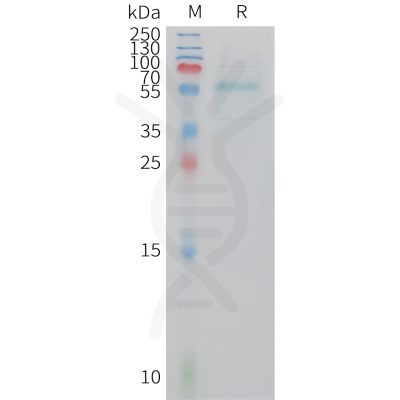 sp-PME101416 ADIPOQ Fig.1 SDS PAGE 1