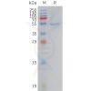 sp-PME101419 CRCP Fig.1 SDS PAGE 1