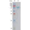 sp-PME101420 IFNA2 Fig.1 SDS PAGE 1