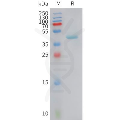 sp-PME101421 CCL5 Fig.1 SDS PAGE 1