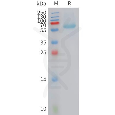 sp-PME101423 BAMBI Fig.1 SDS PAGE 1