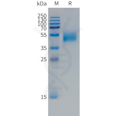 sp-PME101495 FCRL5 Fig.1 SDS PAGE 1