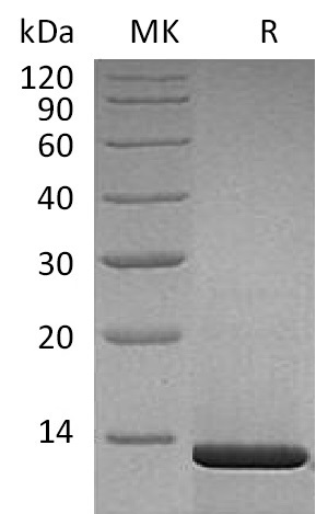 Human Beta-NGF (Mammalian) Protein - 专注肿瘤免疫