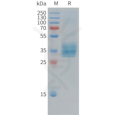 sp-pme c100039 mesothelin sp1