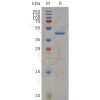 sp-pme m100023 rnase4 sp1