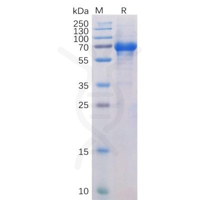 sp-pme100022 ox40 sp1