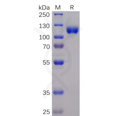 sp-pme100045 epha3 sp1