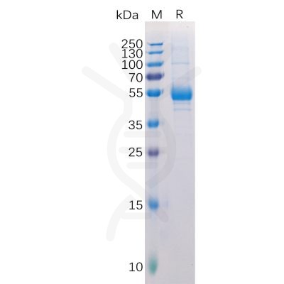 sp-pme100100 tnfsf11 sp1