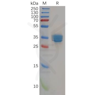 sp-pme100156 cb2 sp1