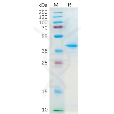 sp-pme100159 ccl20 sp1