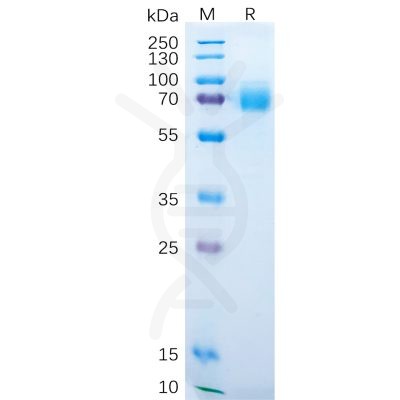 sp-pme100230 dkk1 sp1