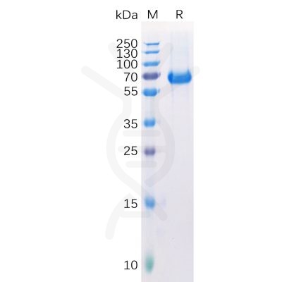 sp-pme100238 epha2 sp1