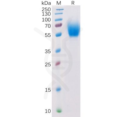 sp-pme100291 il13ra1 sp1