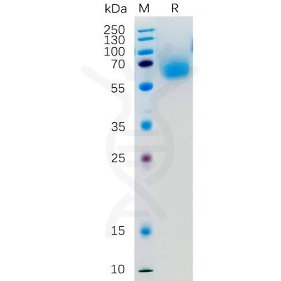 sp-pme100321 klrg1 sp1