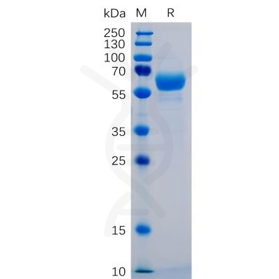 sp-pme100402 siglec15 sp1