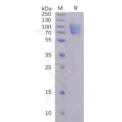 sp-pme100492 s1 protein ntd sp1